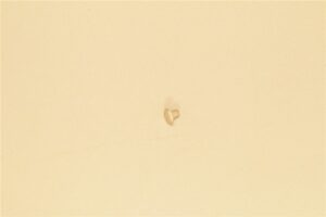 MS25470AD5-3-5
